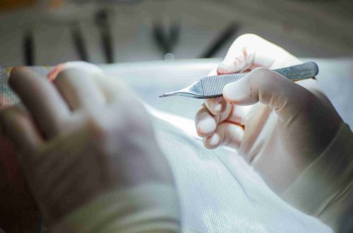 hands of the surgeon and the assistant operate on the patient.